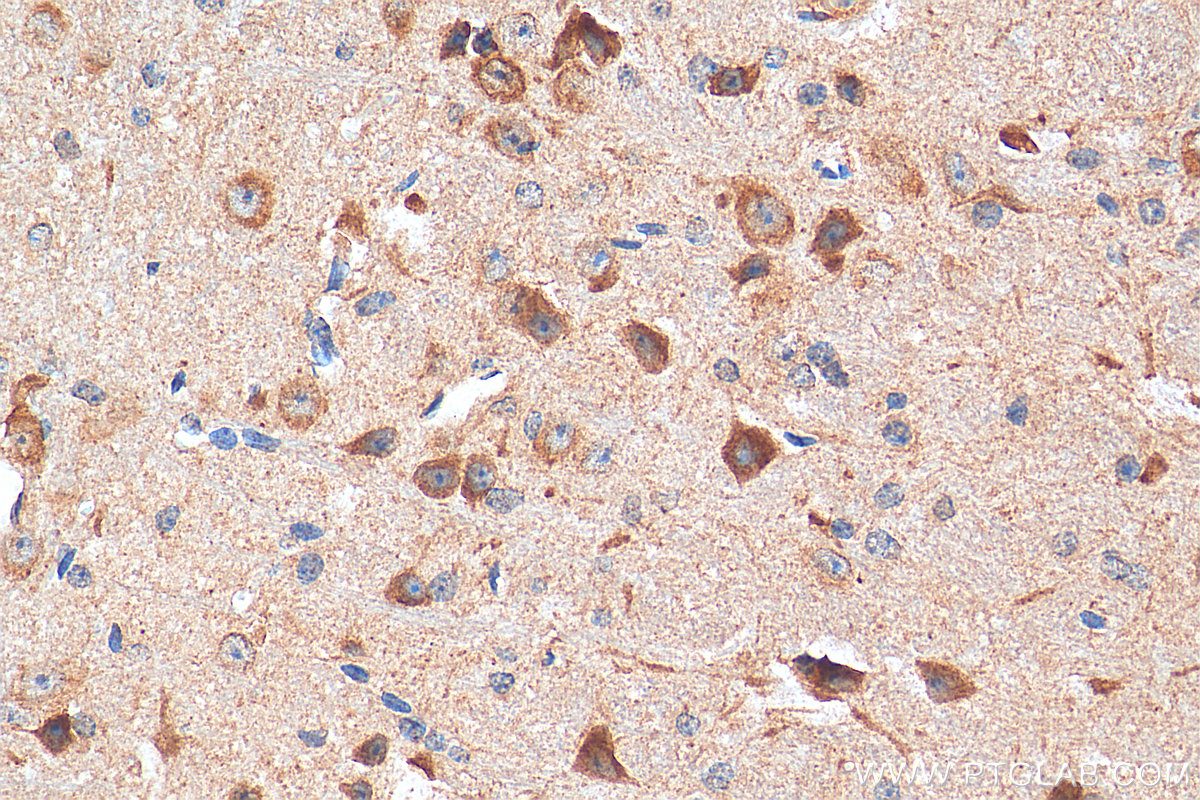 IHC staining of mouse cerebellum using 27676-1-AP