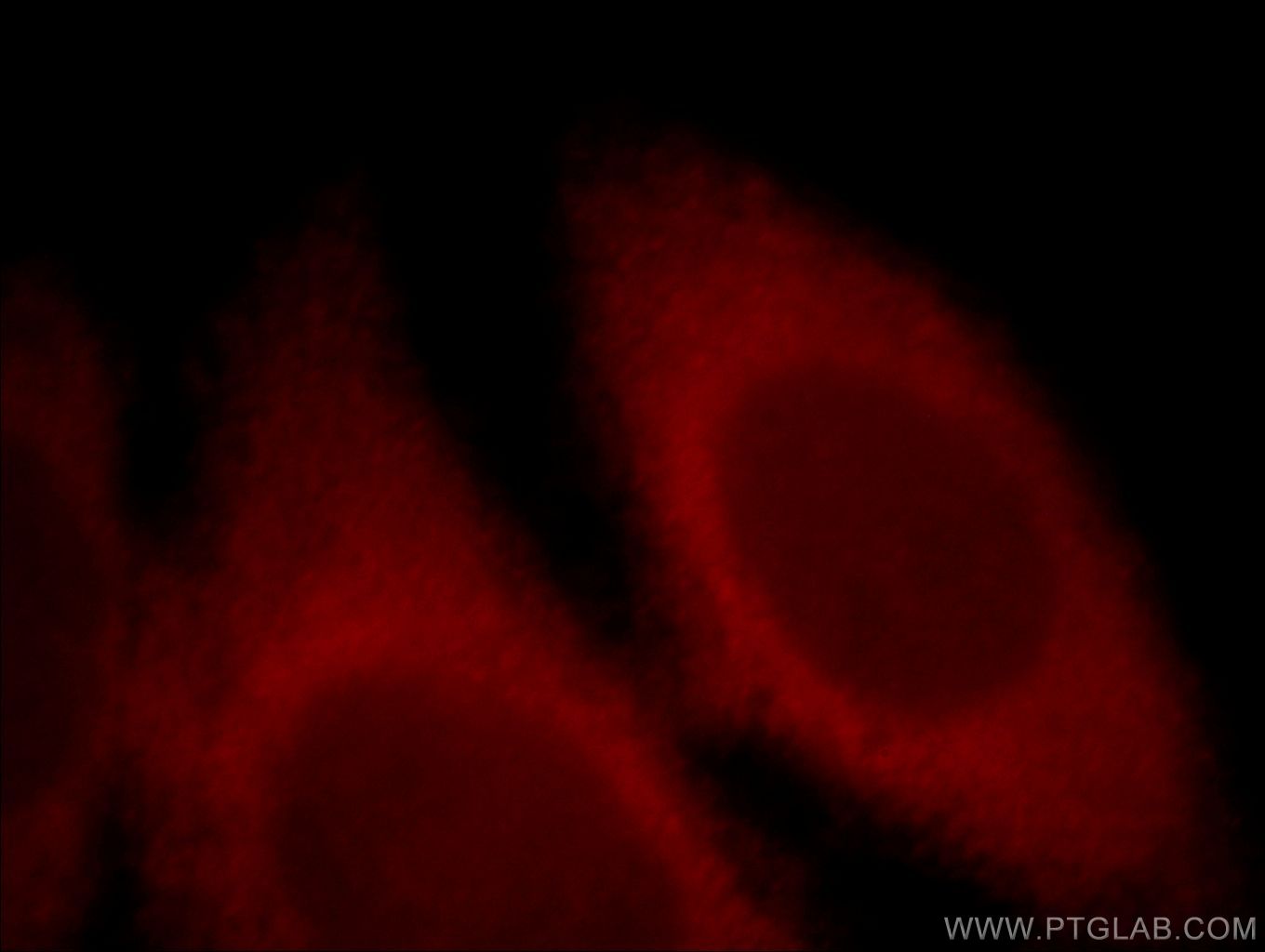 IF Staining of HeLa using 19953-1-AP