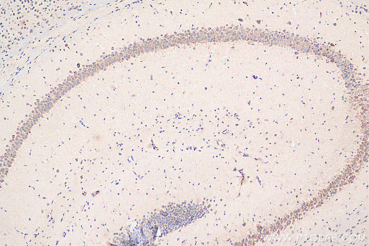 IHC staining of mouse brain using 19953-1-AP
