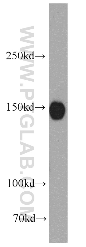 NMDAR2A/GRIN2A Polyclonal antibody