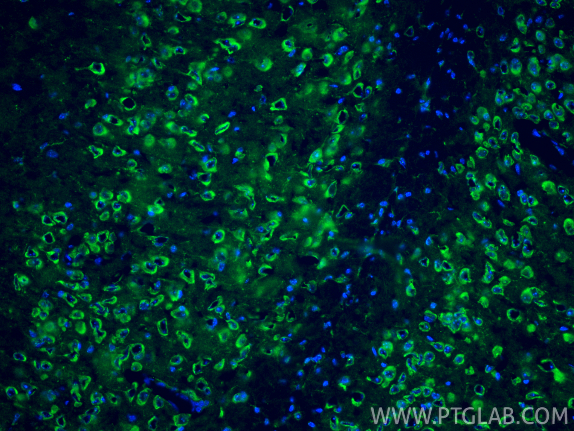 Immunofluorescent analysis of (4% PFA) fixed frozen OCT-embedded mouse brain tissue using NMDAR2B/GRIN2B antibody (21920-1-AP) at dilution of 1:200 and CoraLite®488-Conjugated Goat Anti-Rabbit IgG(H+L) (<a class='green' href='/productredirect?CatalogNo=SA00013-2' target='_blank'>SA00013-2</a>). IF Staining of mouse brain using 21920-1-AP