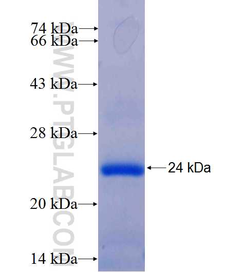 GRIN2C fusion protein Ag25867 SDS-PAGE