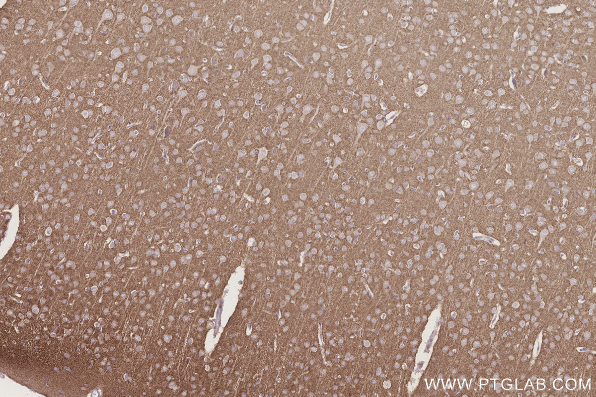IHC staining of rat brain using 20851-1-AP IHC staining of rat brain using 20851-1-AP