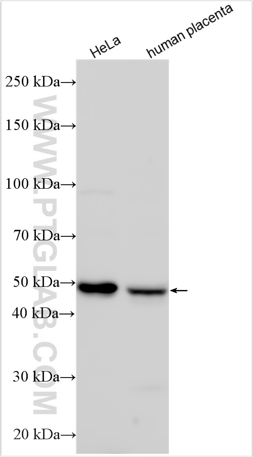WB analysis using 20851-1-AP