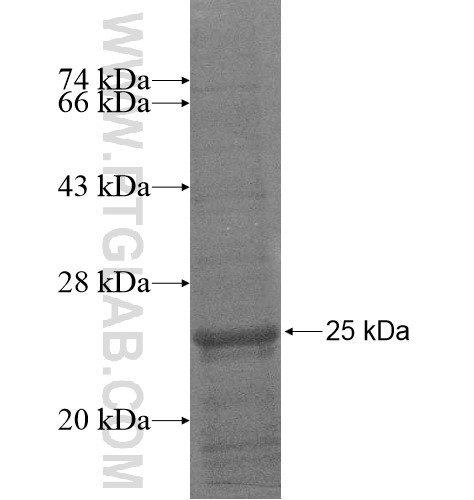 GRINA fusion protein Ag15143 SDS-PAGE GRINA fusion protein Ag15143 SDS-PAGE