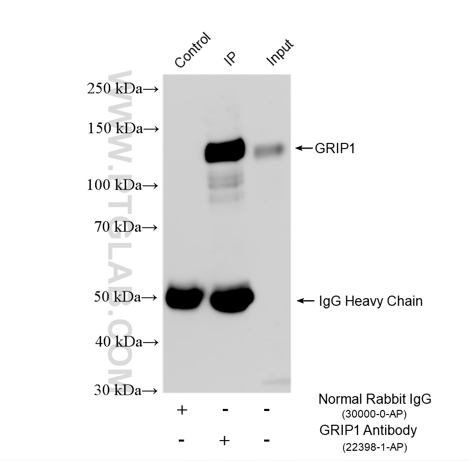 IP experiment of rat brain using 22398-1-AP