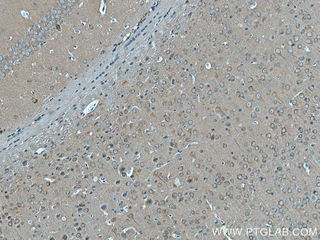IHC staining of mouse brain using 15806-1-AP