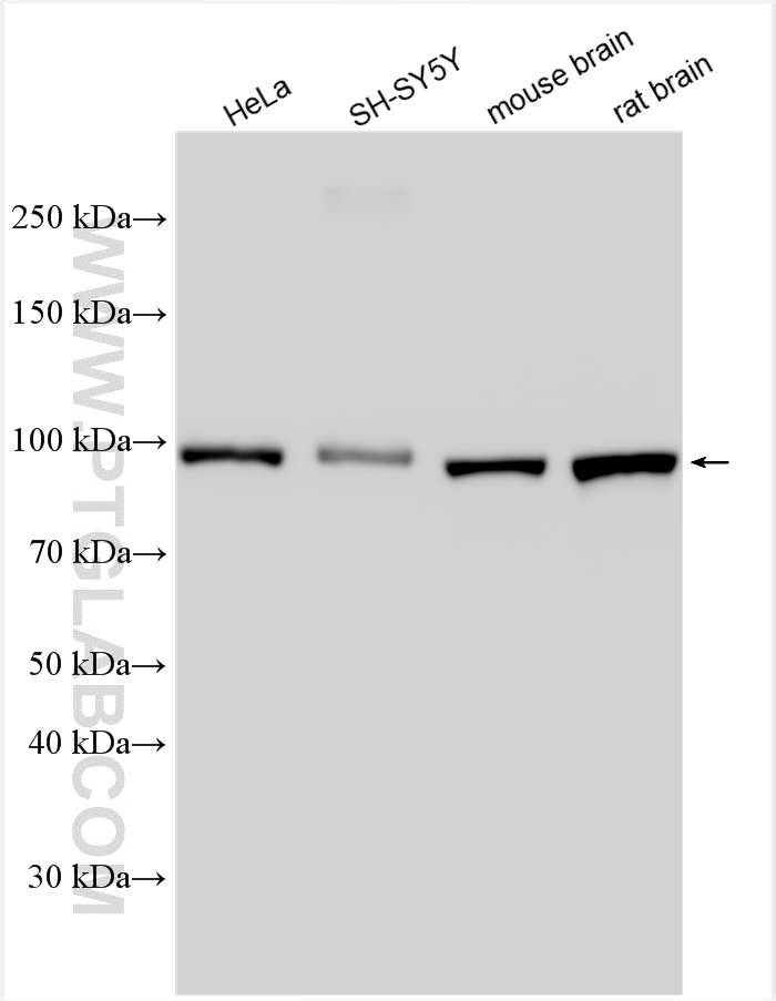 WB analysis using 15806-1-AP