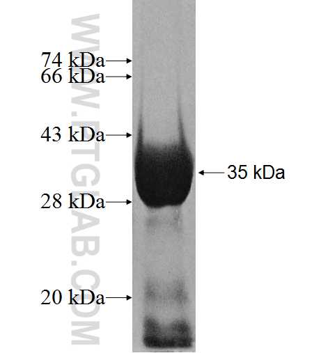 GRIPAP1 fusion protein Ag8654 SDS-PAGE