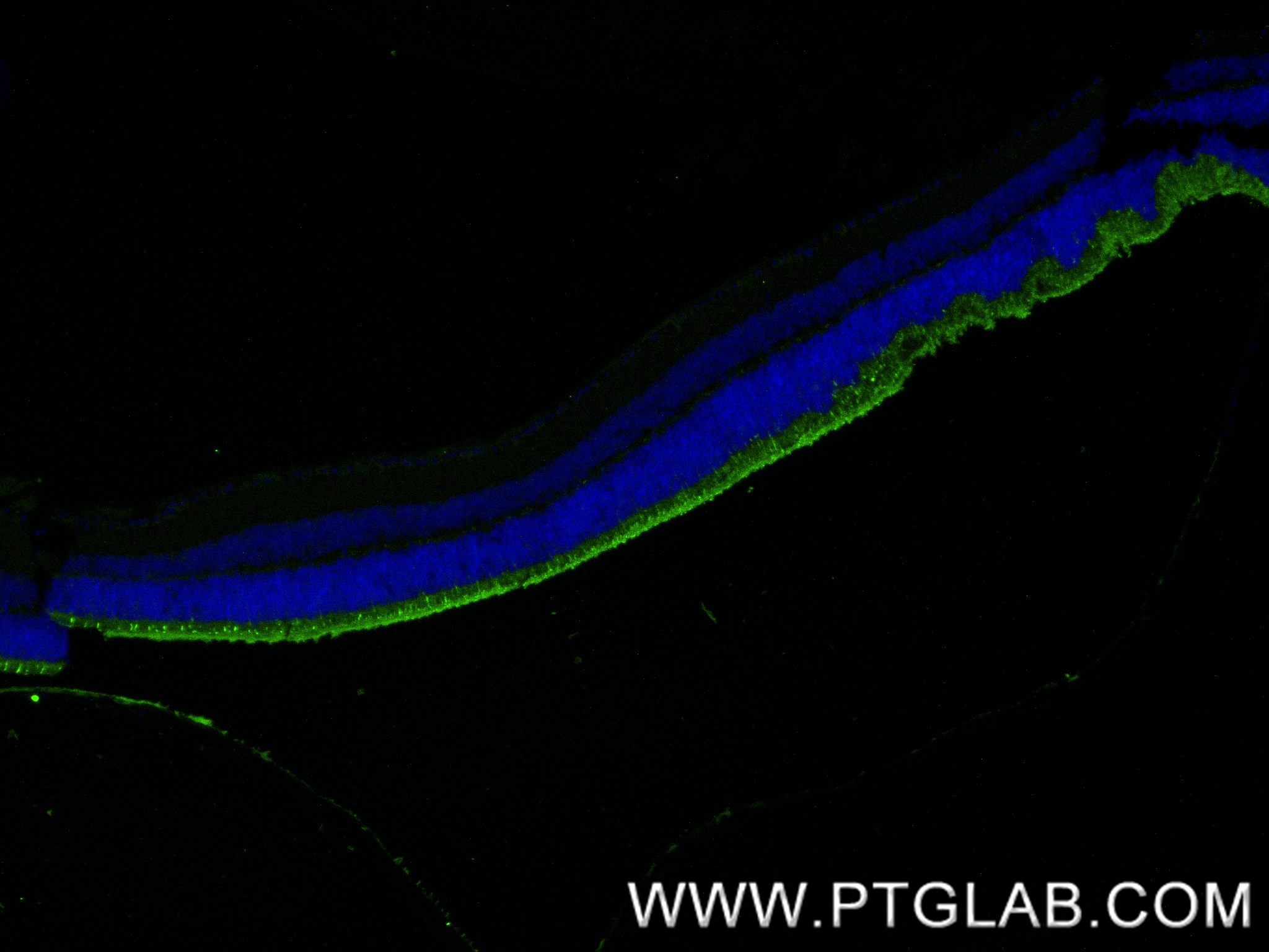 IF Staining of mouse eye using 85942-1-RR (same clone as 85942-1-PBS)