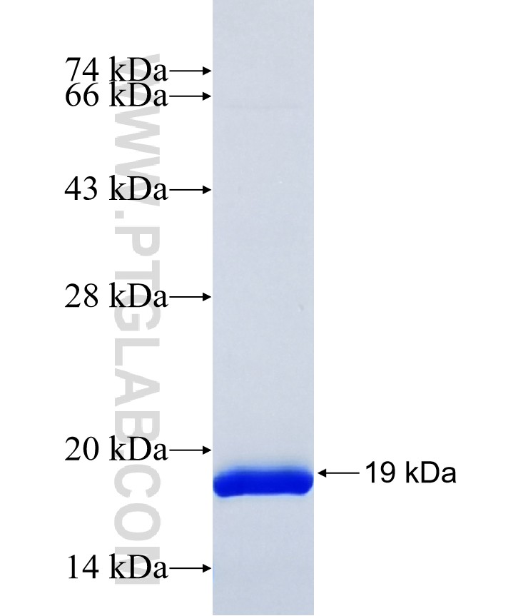 GRK4 fusion protein Ag38107 SDS-PAGE GRK4 fusion protein Ag38107 SDS-PAGE