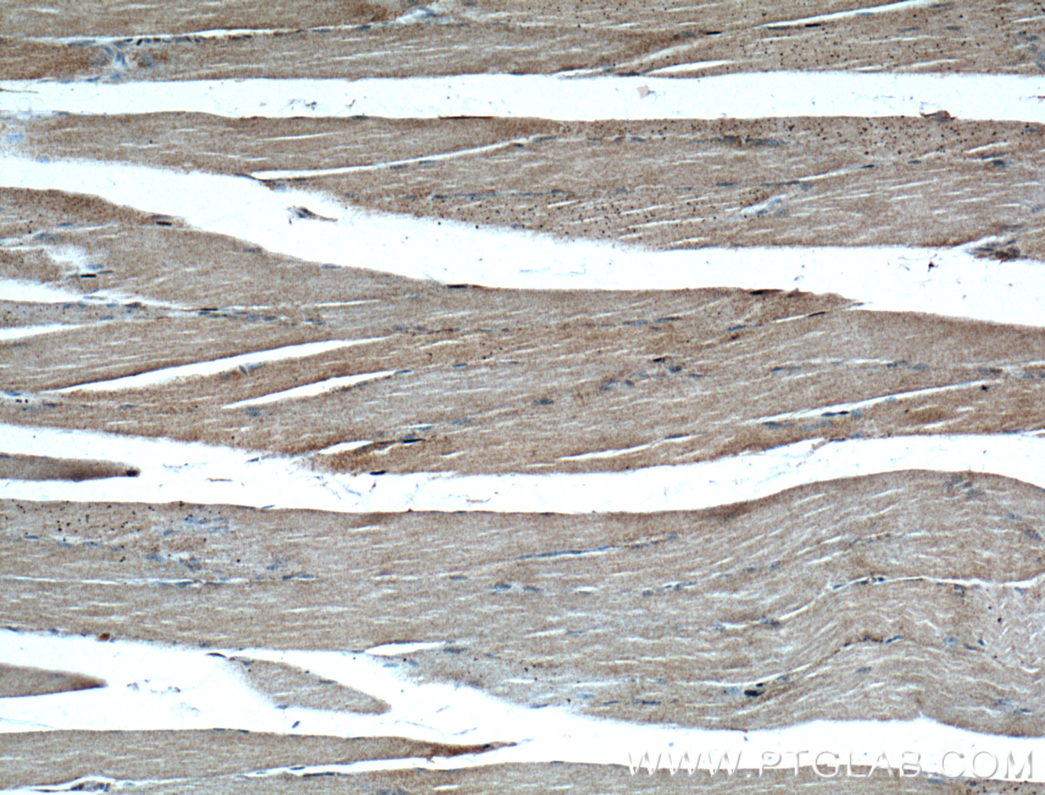 IHC staining of human skeletal muscle using 17032-1-AP (same clone as 17032-1-PBS)