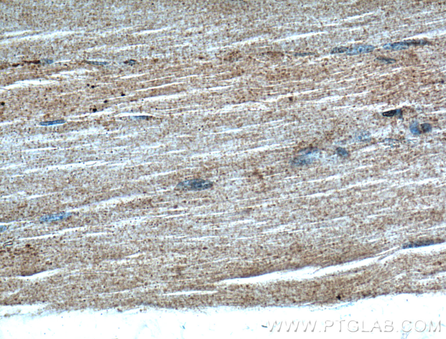 IHC staining of human skeletal muscle using 17032-1-AP (same clone as 17032-1-PBS)