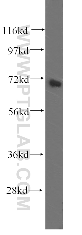 WB analysis of human skeletal muscle using 17032-1-AP