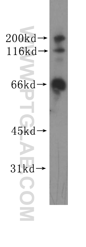 WB analysis of HEK-293 using 11439-1-AP