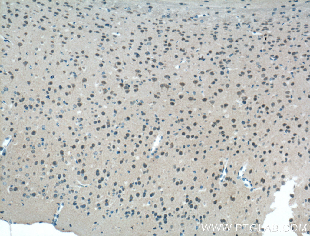 IHC staining of mouse brain using 19955-1-AP