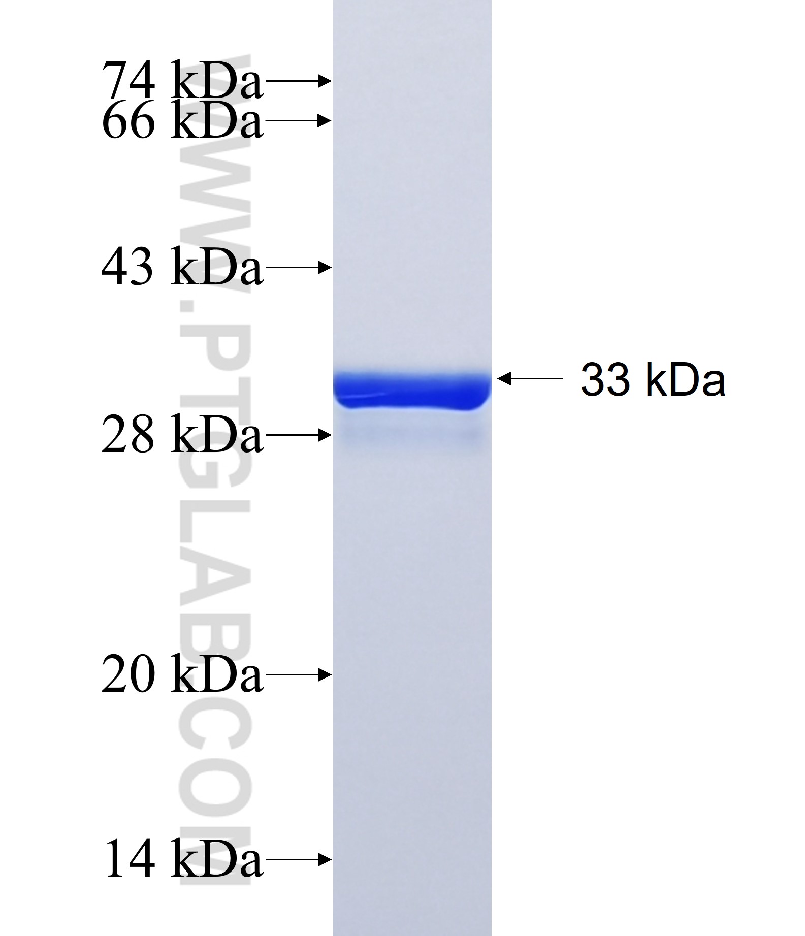 GRM2 fusion protein Ag40323 SDS-PAGE GRM2 fusion protein Ag40323 SDS-PAGE