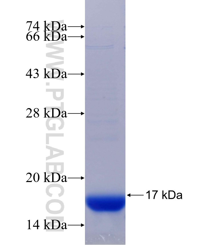 GRP fusion protein Ag29370 SDS-PAGE