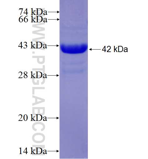 GRP fusion protein Ag6239 SDS-PAGE