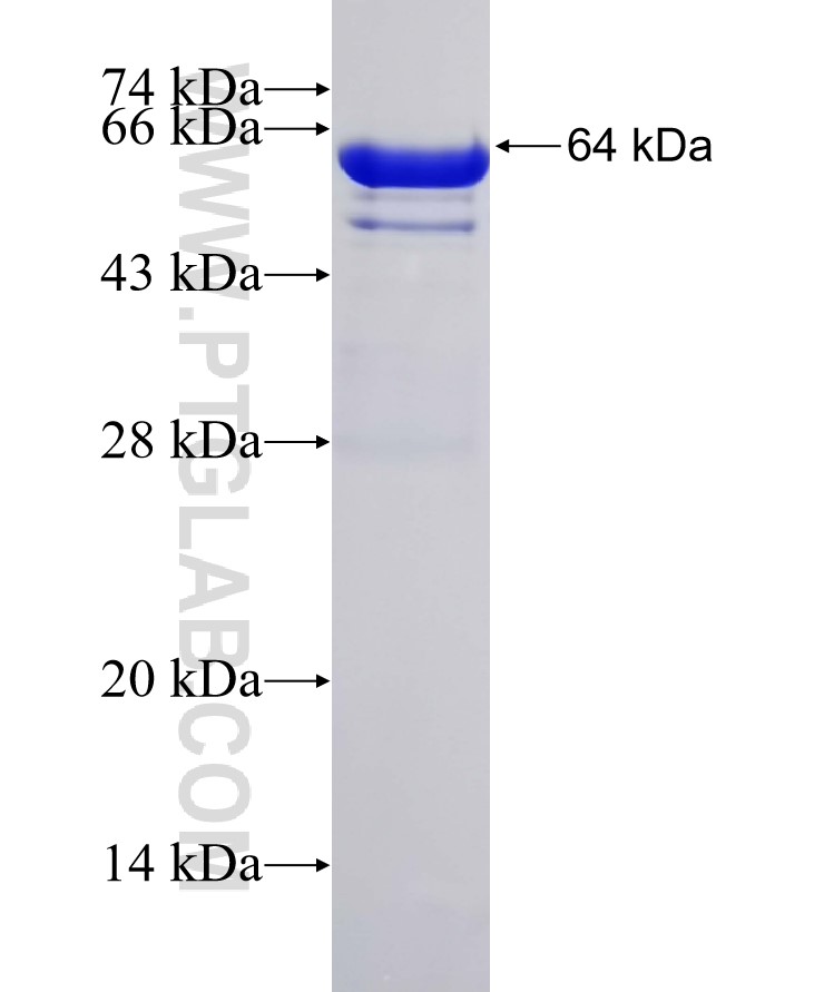 GRP75 fusion protein Ag6673 SDS-PAGE