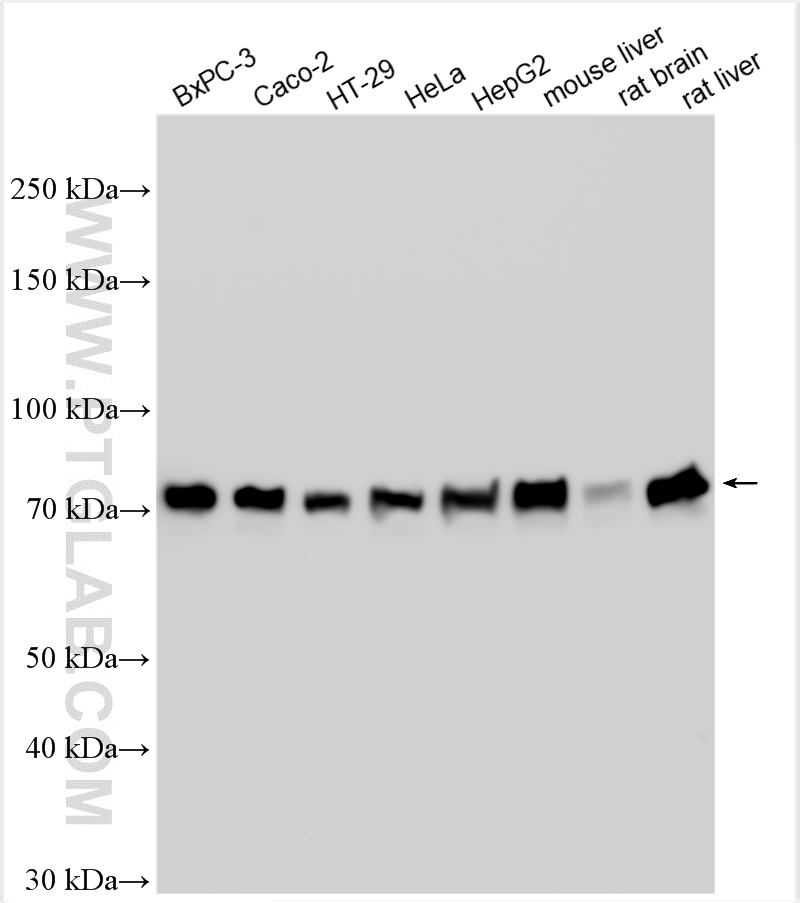 WB analysis using 11587-1-AP