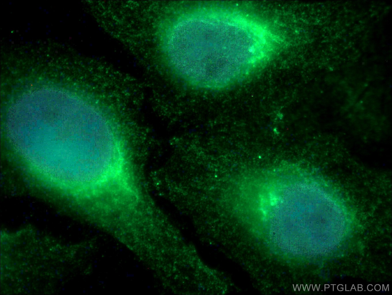 IF Staining of HeLa using 66574-1-Ig (same clone as 66574-1-PBS)