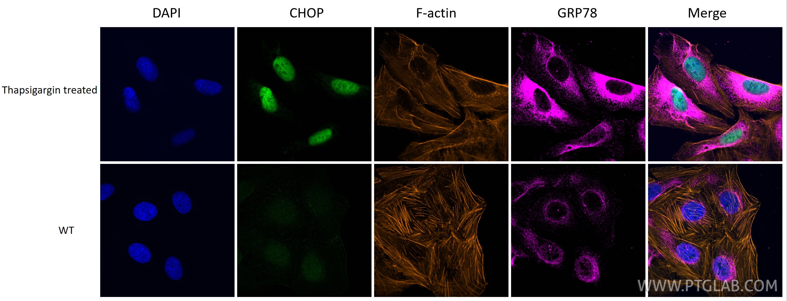 IF Staining of U2OS using 66574-1-Ig IF Staining of U2OS using 66574-1-Ig