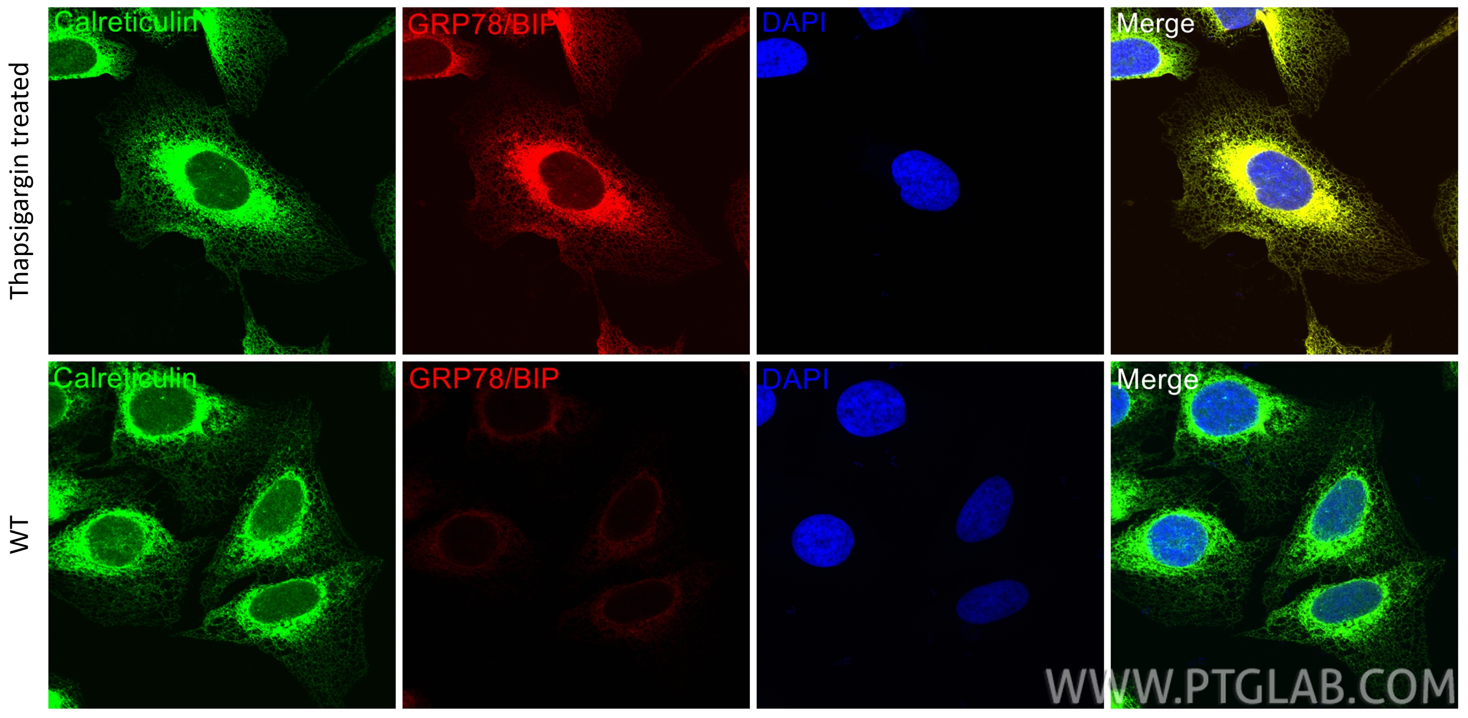 IF Staining of U2OS using CL594-11587 IF Staining of U2OS using CL594-11587