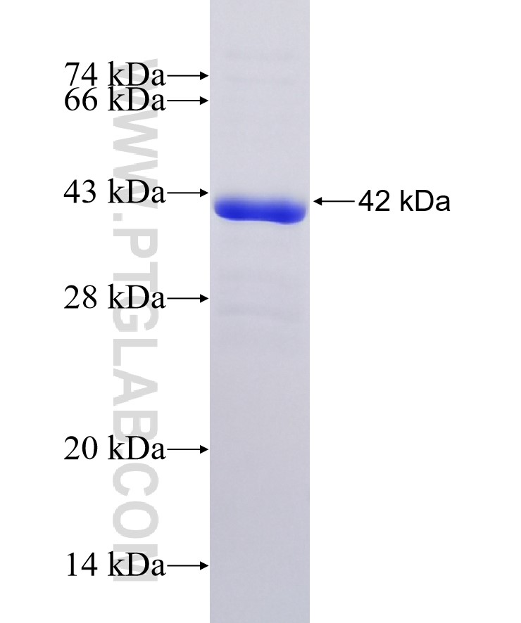 GRP78,BIP fusion protein Ag32370 SDS-PAGE GRP78,BIP fusion protein Ag32370 SDS-PAGE