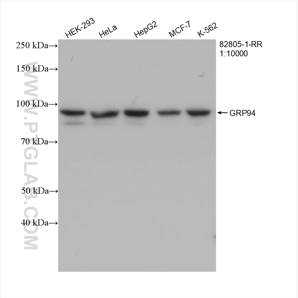 WB analysis using 82805-1-RR