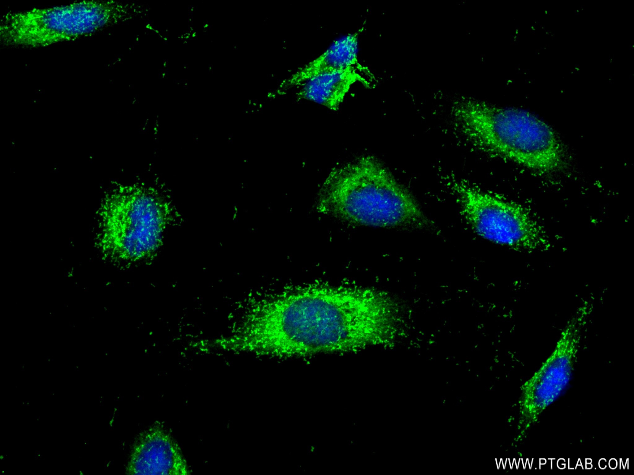 IF Staining of HeLa using 83147-5-RR