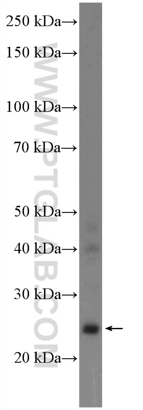 WB analysis of mouse liver using 17751-1-AP