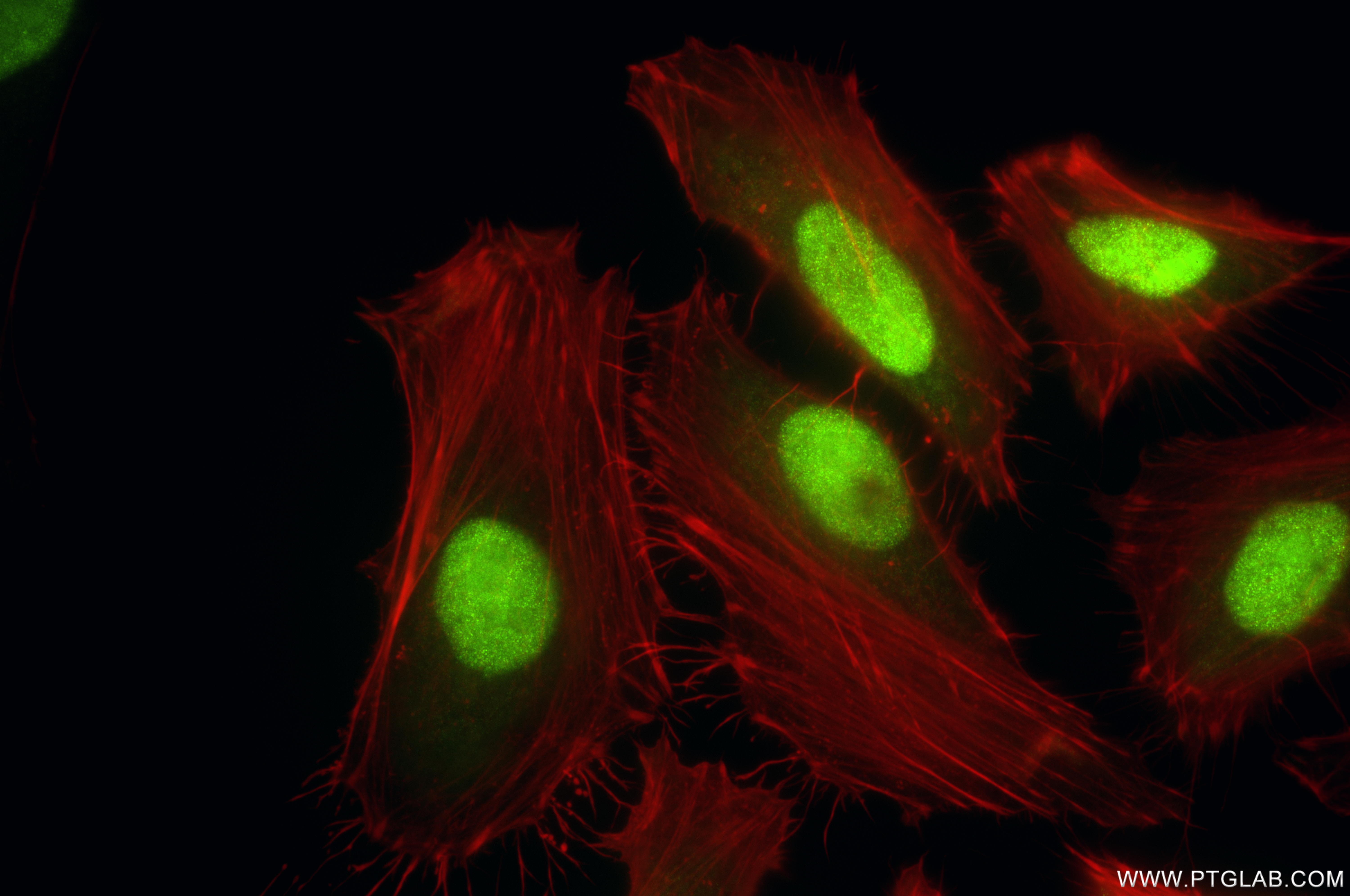 IF Staining of HeLa using 86451-3-RR