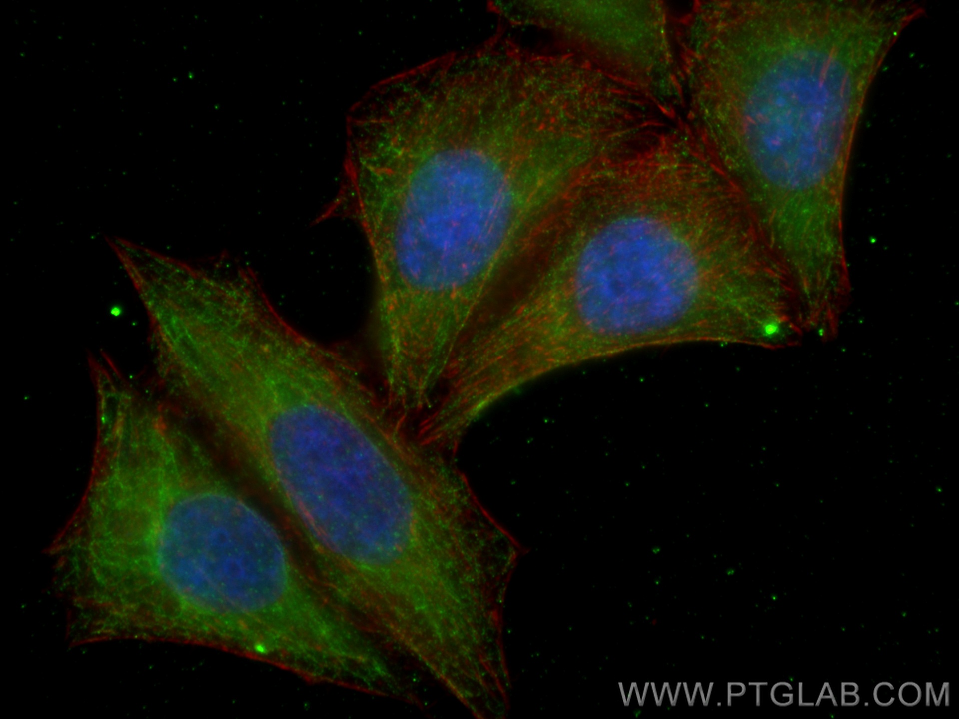 IF Staining of HepG2 using 67527-1-Ig (same clone as 67527-1-PBS)