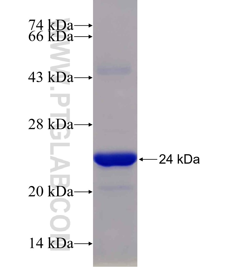 GSDMB fusion protein Ag30217 SDS-PAGE
