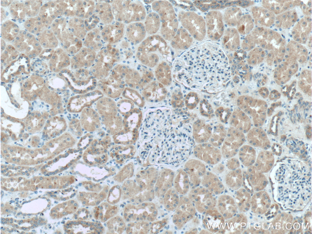 IHC staining of human kidney using 27630-1-AP