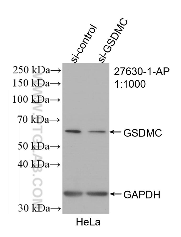 WB analysis of HeLa using 27630-1-AP