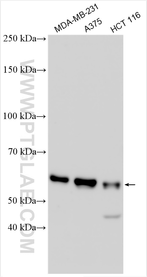 WB analysis using 30469-1-AP