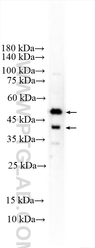 WB analysis of THP-1 using 30531-1-AP