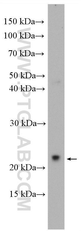 WB analysis of U-251 using 17328-1-AP