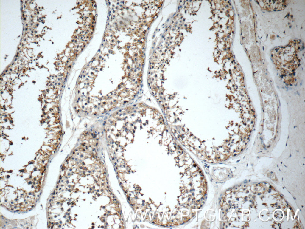 IHC staining of human testis using 15113-1-AP