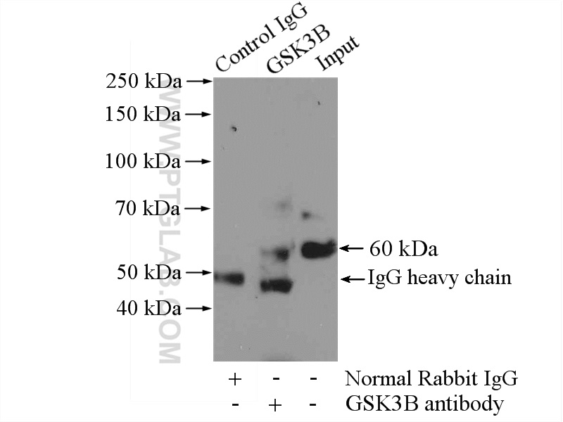 IP experiment of mouse heart using 15113-1-AP