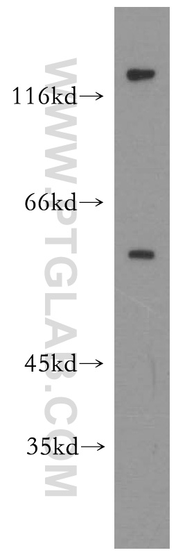 GSK3B Polyclonal antibody