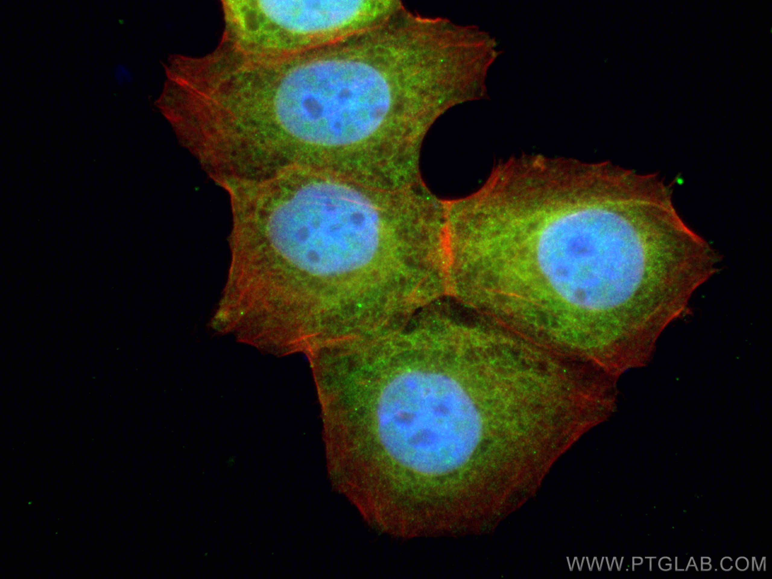 IF Staining of MCF-7 using 22104-1-AP