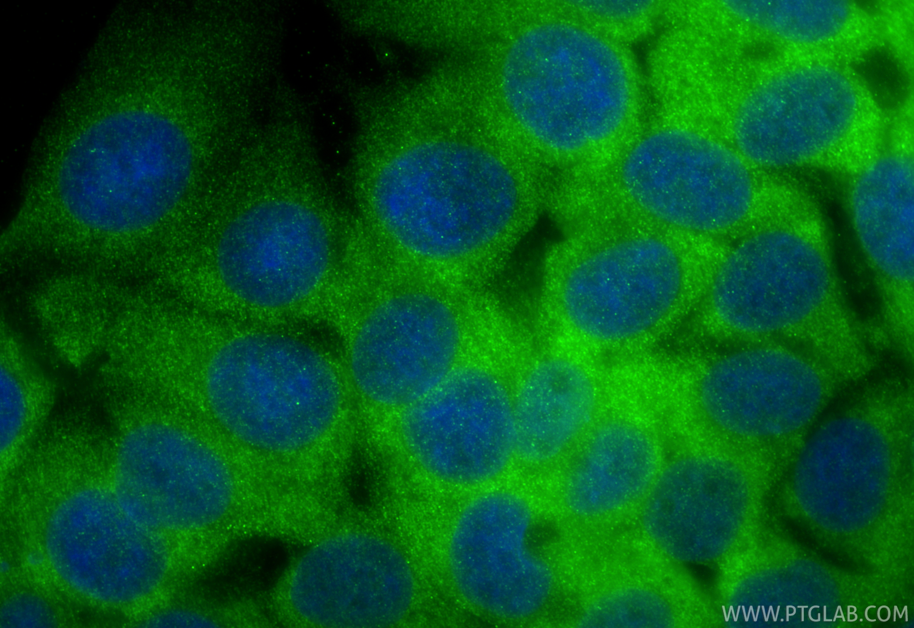 IF Staining of MCF-7 using 22104-1-AP