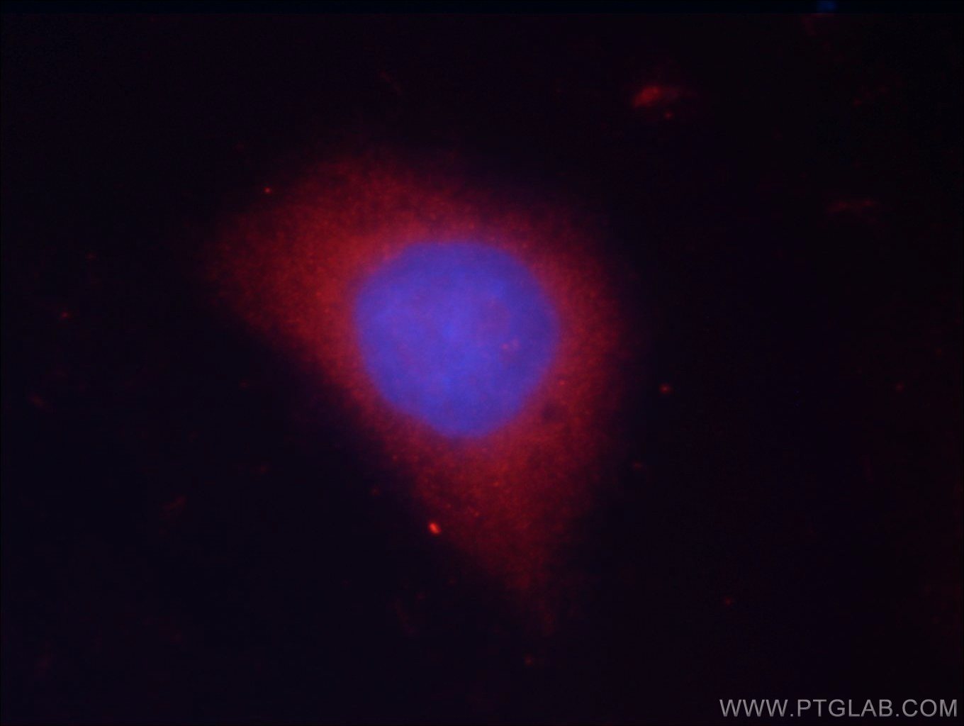 IF Staining of HeLa using 24198-1-AP