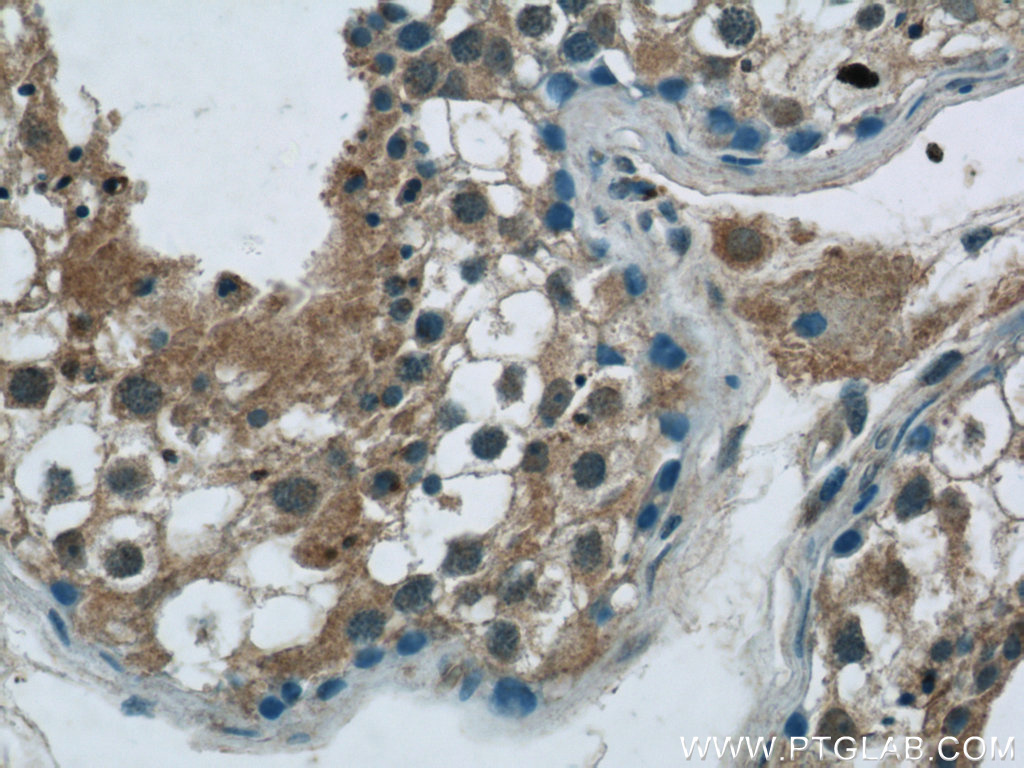 IHC staining of human testis using 24198-1-AP