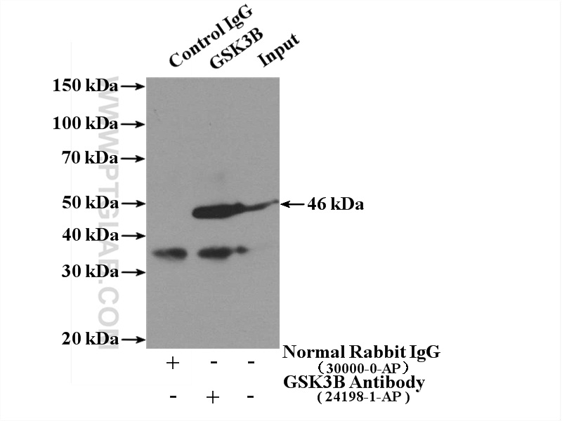 IP experiment of mouse brain using 24198-1-AP