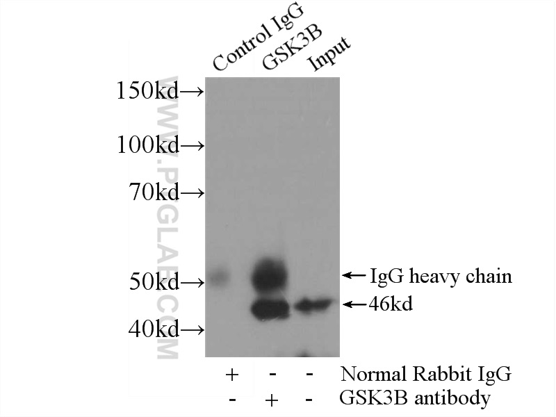 IP experiment of HeLa using 51065-1-AP