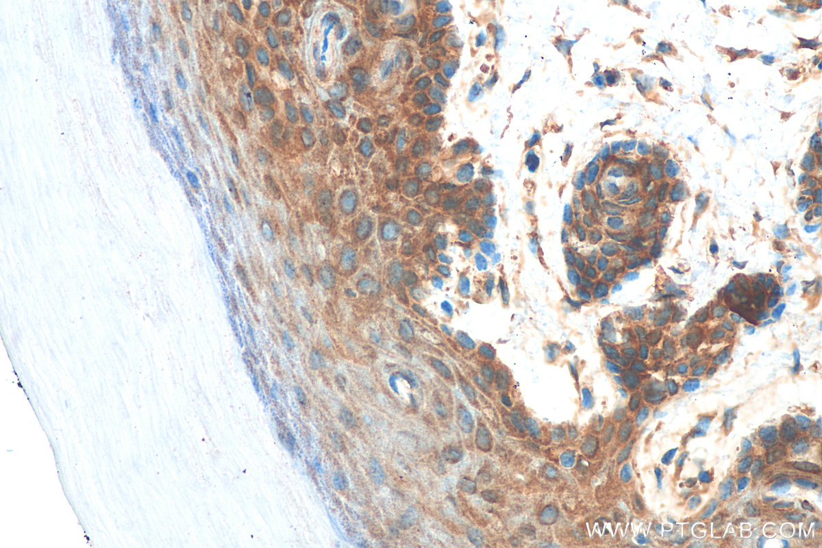 IHC staining of mouse skin using 82061-1-RR
